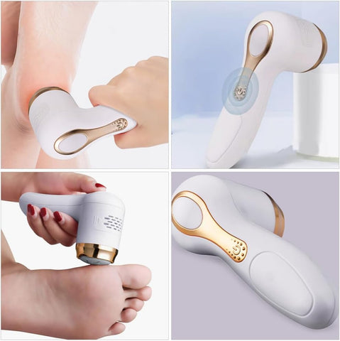 Electric Call us Remover for Feet