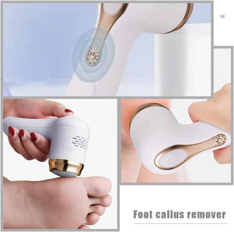 Electric Call us Remover for Feet